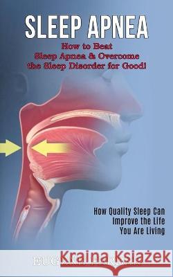 Sleep Apnea: How Quality Sleep Can Improve the Life You Are Living (How to Beat Sleep Apnea & Overcome the Sleep Disorder for Good! Ferber, Eugene 9781990268366 David Kruse