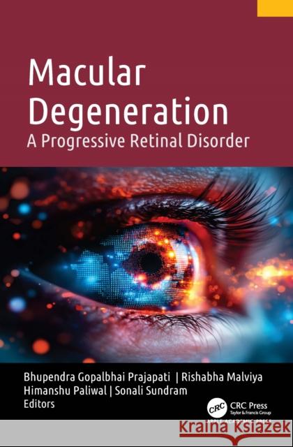 Macular Degeneration: A Progressive Retinal Disorder Bhupendra Prajapati Rishabha Malviya Himanshu Paliwal 9781998511242