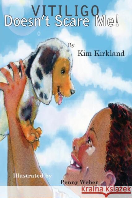 Vitiligo Doesn't Scare Me Kim Kirkland 9782016092231 Asg Productions