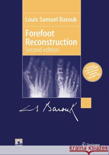 Forefoot Reconstruction Barouk, Louis-Samuel 9782287252518 Springer