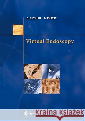 Virtual Endoscopy David Khayat Didier Buthiau D. Buthiau 9782287596582