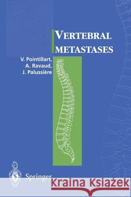 Vertebral Metastases Pointillart, Vincent 9782287597527 Springer