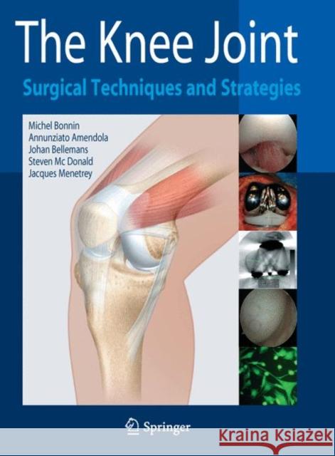 The Knee Joint: Surgical Techniques and Strategies Bonnin, Michel 9782287993527 Springer