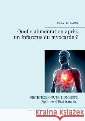 Quelle alimentation après un infarctus du myocarde ? Cedric Menard 9782322132744 Books on Demand