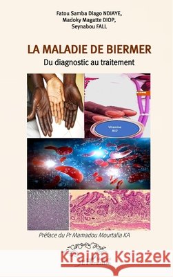 La maladie de Biermer: Du diagnostic au traitement Fatou Samba Diago Ndiaye Madoky Magatte Diop Seynabou Fall 9782336558431