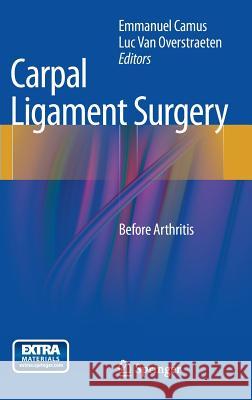 Carpal Ligament Surgery: Before Arthritis Camus, Emmanuel 9782817803784 0