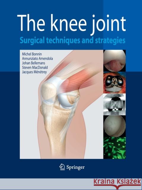 The Knee Joint: Surgical Techniques and Strategies Bonnin, Michel 9782817805467