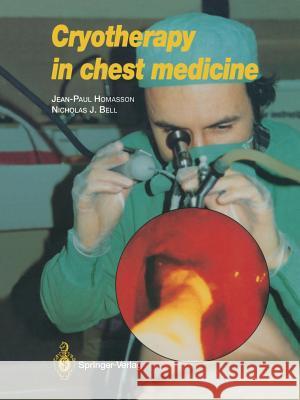Cryotherapy in Chest Medicine Jean-Paul Homasson 9782817808826 Springer