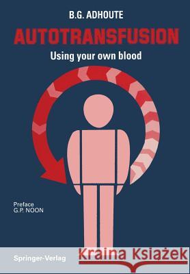 Autotransfusion: Using Your Own Blood Messmer, K. 9782817809175
