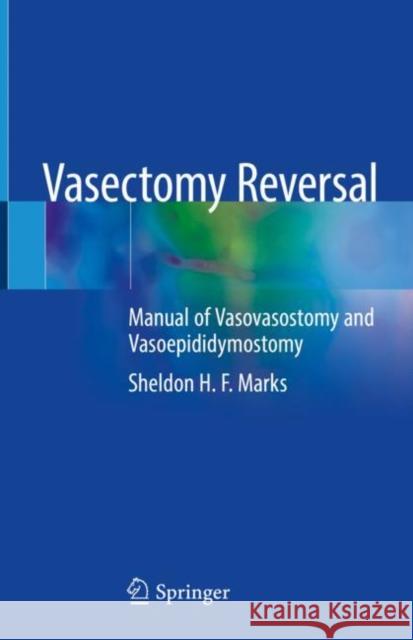 Vasectomy Reversal: Manual of Vasovasostomy and Vasoepididymostomy Marks, Sheldon H. F. 9783030004545