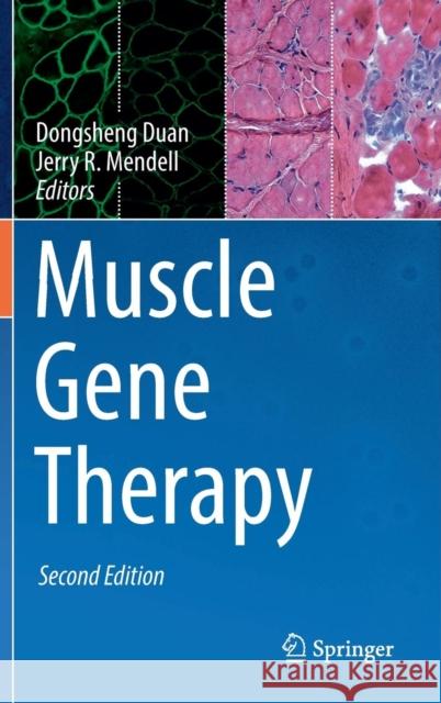 Muscle Gene Therapy Dongsheng Duan Jerry Mendell 9783030030940