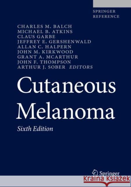 Cutaneous Melanoma Balch, Charles M. 9783030050689 Springer