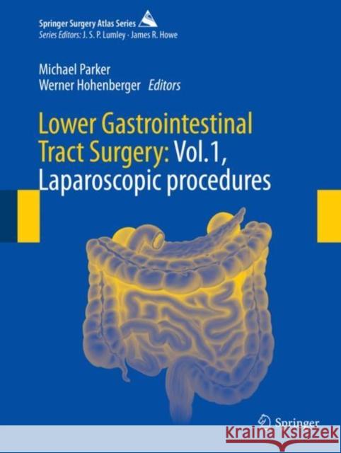 Lower Gastrointestinal Tract Surgery: Vol.1, Laparoscopic Procedures Parker, Michael 9783030052393 Springer