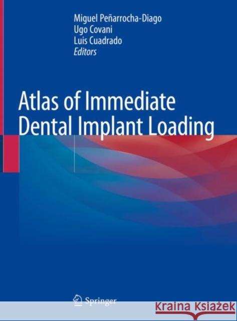 Atlas of Immediate Dental Implant Loading Miguel Penarroch Ugo Covani Luis Cuadrado 9783030055448 Springer