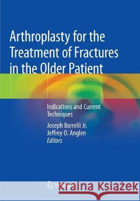 Arthroplasty for the Treatment of Fractures in the Older Patient: Indications and Current Techniques Borrelli Jr, Joseph 9783030068127