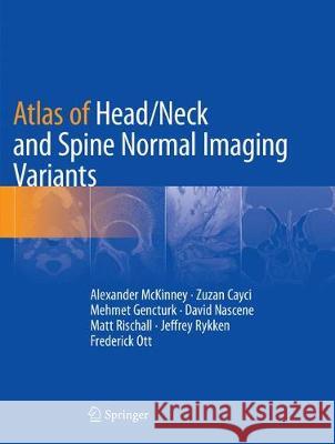 Atlas of Head/Neck and Spine Normal Imaging Variants Alexander McKinney Zuzan Cayci Mehmet Gencturk 9783030070380 Springer
