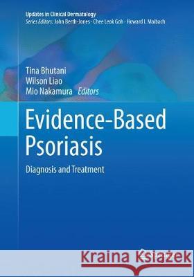 Evidence-Based Psoriasis: Diagnosis and Treatment Bhutani, Tina 9783030079352 Springer