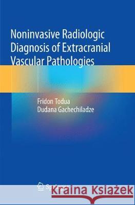 Noninvasive Radiologic Diagnosis of Extracranial Vascular Pathologies Fridon Todua Dudana Gachechiladze 9783030082376 Springer
