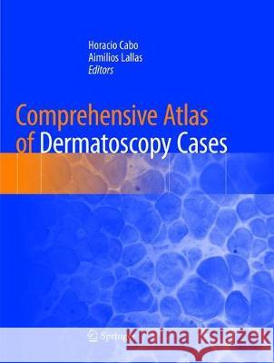 Comprehensive Atlas of Dermatoscopy Cases Horacio Cabo Aimilios Lallas 9783030083281 Springer