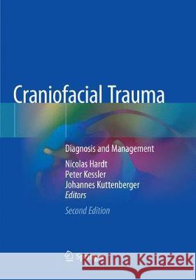 Craniofacial Trauma: Diagnosis and Management Hardt, Nicolas 9783030083984 Springer