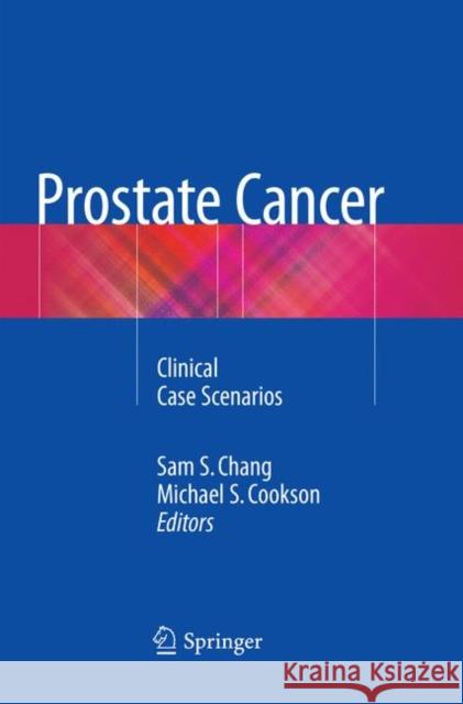 Prostate Cancer : Clinical Case Scenarios Sam S. Chang Michael S. Cookson 9783030087555 