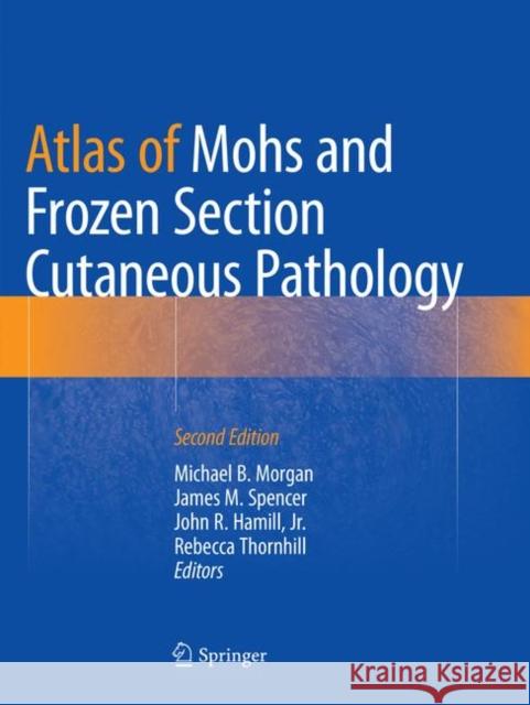 Atlas of Mohs and Frozen Section Cutaneous Pathology Michael B. Morgan James M. Spencer John R. Hamil 9783030090906 Springer