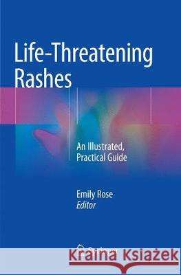 Life-Threatening Rashes: An Illustrated, Practical Guide Rose, Emily 9783030092818