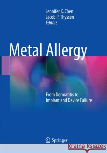 Metal Allergy: From Dermatitis to Implant and Device Failure Chen, Jennifer K. 9783030096328 Springer