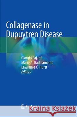Collagenase in Dupuytren Disease Giorgio Pajardi Marie A. Badalamente Lawrence C. Hurst 9783030097493 Springer