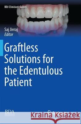 Graftless Solutions for the Edentulous Patient Saj Jivraj 9783030097523 Springer