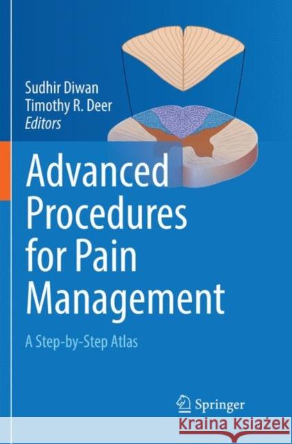 Advanced Procedures for Pain Management: A Step-By-Step Atlas Diwan, Sudhir 9783030098544 Springer