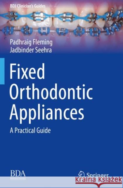 Fixed Orthodontic Appliances: A Practical Guide Fleming, Padhraig 9783030121679 Springer International Publishing