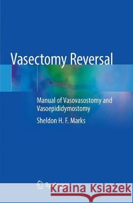 Vasectomy Reversal: Manual of Vasovasostomy and Vasoepididymostomy Marks, Sheldon H. F. 9783030131159