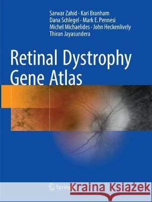 Retinal Dystrophy Gene Atlas Sarwar Zahid Kari Branham Dana Schlegel 9783030132347 Springer