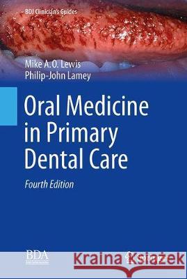 Oral Medicine in Primary Dental Care Michael A. O. Lewis Philip-John Lamey 9783030154318 Springer