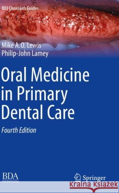 Oral Medicine in Primary Dental Care Michael A. O. Lewis Philip-John Lamey 9783030154349 Springer