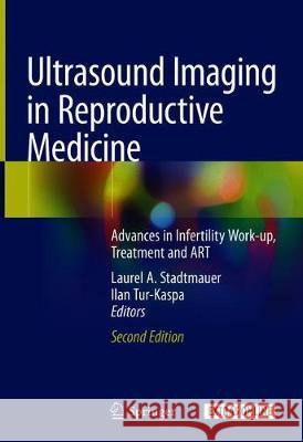 Ultrasound Imaging in Reproductive Medicine: Advances in Infertility Work-Up, Treatment and Art Stadtmauer, Laurel A. 9783030166984 Springer