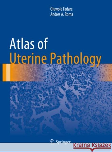 Atlas of Uterine Pathology Oluwole Fadare Andres A. Roma 9783030179304