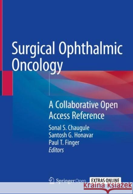 Surgical Ophthalmic Oncology: A Collaborative Open Access Reference Chaugule, Sonal S. 9783030187569