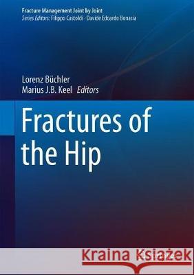 Fractures of the Hip Lorenz Buchler Marius J. B. Keel 9783030188375