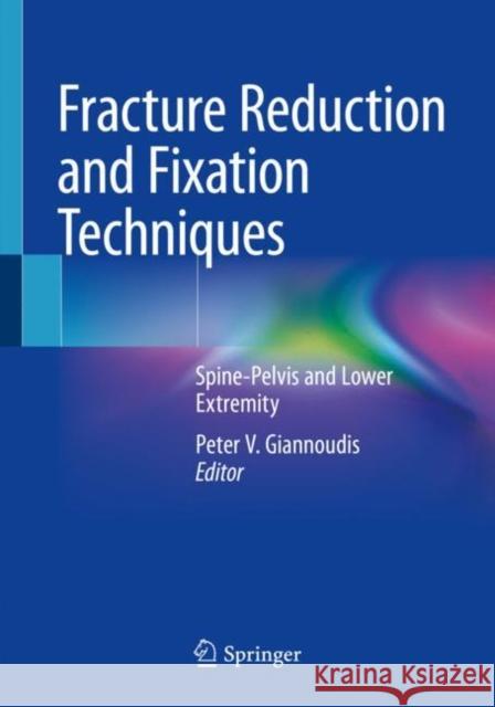 Fracture Reduction and Fixation Techniques: Spine-Pelvis and Lower Extremity Peter V. Giannoudis 9783030246105