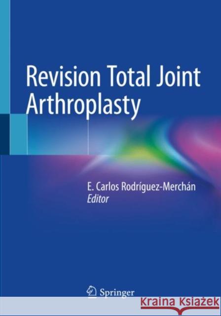 Revision Total Joint Arthroplasty Rodr 9783030247751 Springer