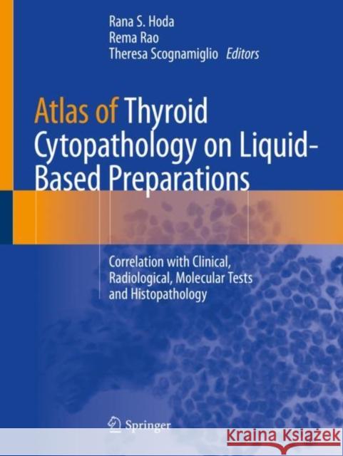 Atlas of Thyroid Cytopathology on Liquid-Based Preparations: Correlation with Clinical, Radiological, Molecular Tests and Histopathology Hoda, Rana S. 9783030250683 Springer International Publishing