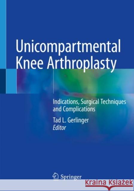 Unicompartmental Knee Arthroplasty: Indications, Surgical Techniques and Complications Tad L. Gerlinger 9783030274139 Springer