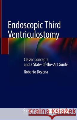Endoscopic Third Ventriculostomy: Classic Concepts and a State-Of-The-Art Guide Dezena, Roberto Alexandre 9783030286569 Springer