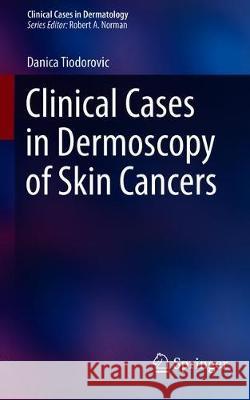 Clinical Cases in Dermoscopy of Skin Cancers Danica Tiodorovic 9783030294465 Springer