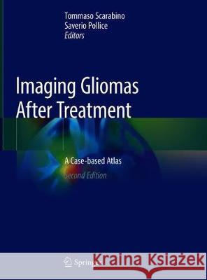 Imaging Gliomas After Treatment: A Case-Based Atlas Scarabino, Tommaso 9783030312091 Springer