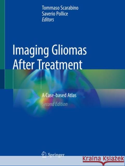 Imaging Gliomas After Treatment: A Case-Based Atlas Tommaso Scarabino Saverio Pollice 9783030312121 Springer