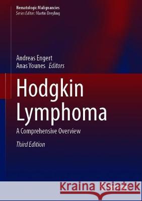 Hodgkin Lymphoma: A Comprehensive Overview Engert, Andreas 9783030324810