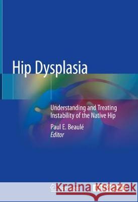 Hip Dysplasia: Understanding and Treating Instability of the Native Hip Beaulé, Paul E. 9783030333577 Springer